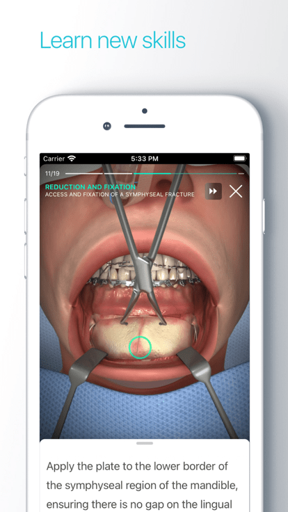 安卓touch surgery 安卓版app